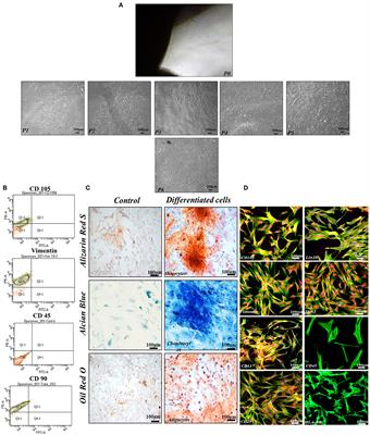 Co-regulation of Sox9 and TGFβ1 transcription factors in mesenchymal stem cells regenerated the intervertebral disc degeneration